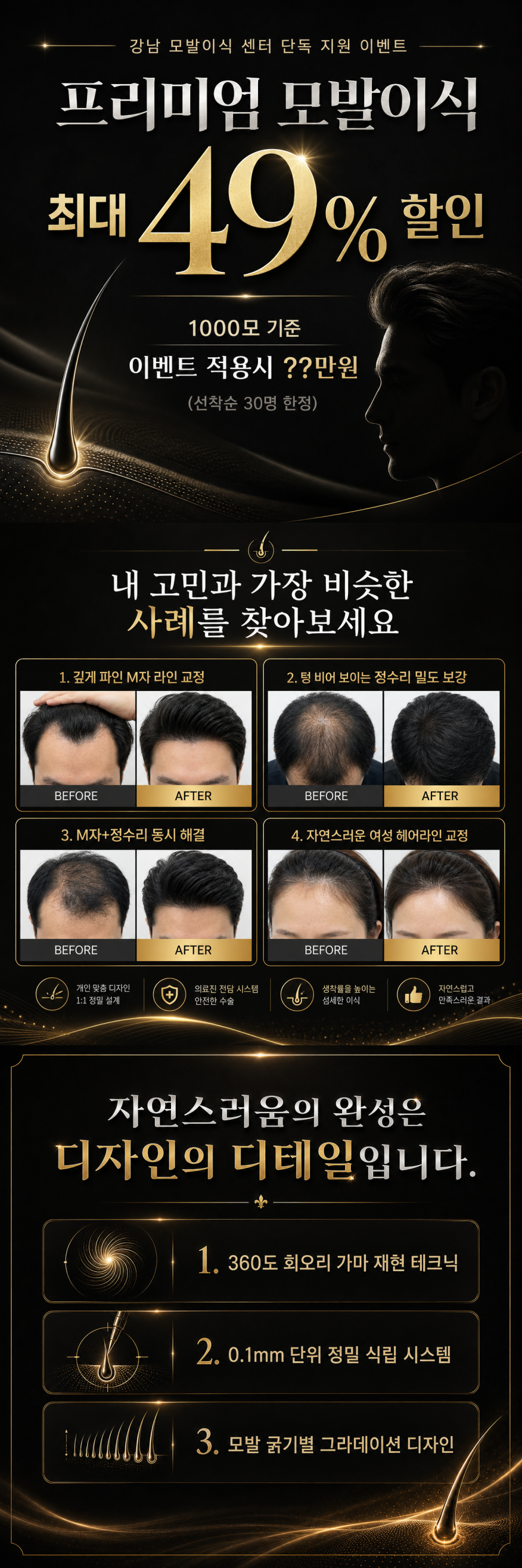 오산 모발이식 병원 이벤트 최대 49% 할인